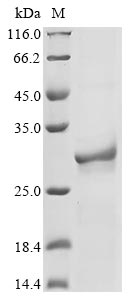 Mouse Nrk1 protein