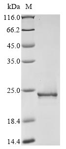 ppdK protein