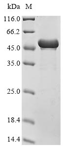 Human CELF1 protein