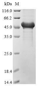 Human CELF1 protein