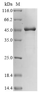 Human POTEKP protein
