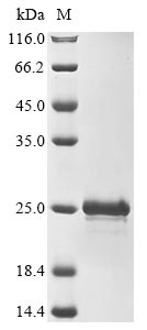 Mouse Tmsb10 protein