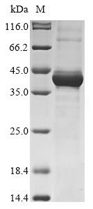 Human MELK protein