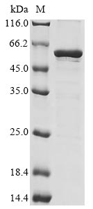 Human CBX8 protein
