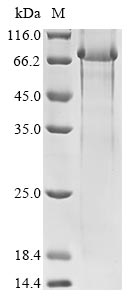 Human PKD1 protein
