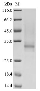 Human TPSB2 protein