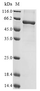 Human SPTA1 protein