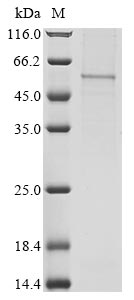 Human COMMD5 protein