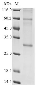 Human INSIG2 protein