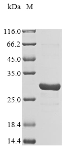 Human FBXO48 protein
