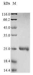 Culex quinquefasciatus Odorant binding protein OBP28 protein