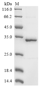 Mouse Tpp2 protein
