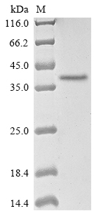 adenovirus B serotype 11 Fiber protein