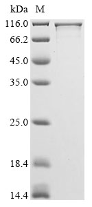 Human STRN3 protein
