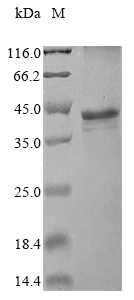Human KNSTRN protein