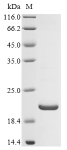 Human CPS1 protein
