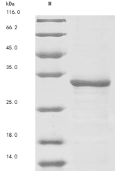 Mouse Tpp2 protein