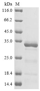 Human TPP2 protein