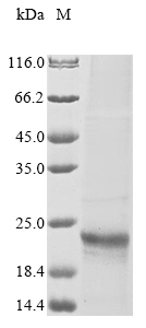 Culex quinquefasciatus Submitted name: Odorant binding protein OBP28 protein