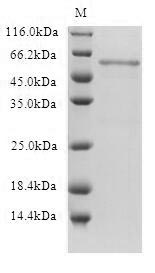 Human HTR1B protein
