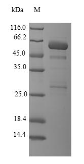 Human LGALS8 protein
