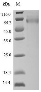 Human ULBP1 protein