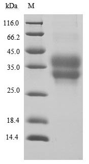 Human PDCD1 protein