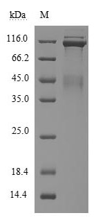 Human MET protein