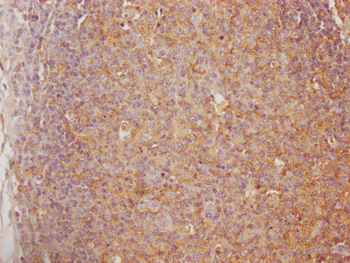 CHIT1 Antibody