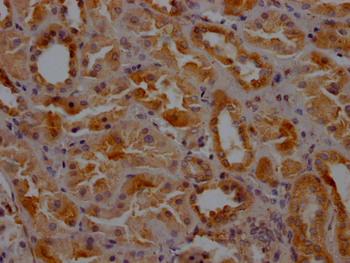CLTC Antibody