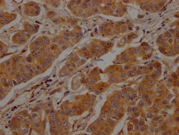 CLTC Antibody