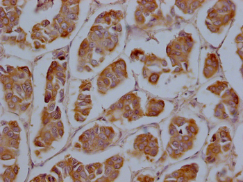 CYP2A13 Antibody