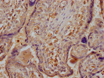 DAPP1 Antibody