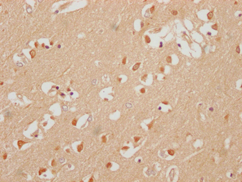 ELAVL3 Antibody