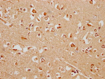 HHIP Antibody