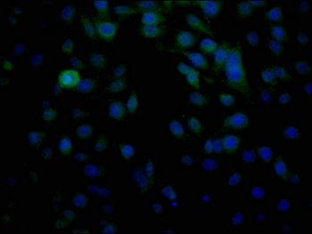 HLA-B Antibody