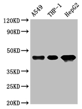 HLA-B Antibody