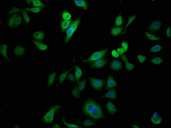 HLA-B Antibody