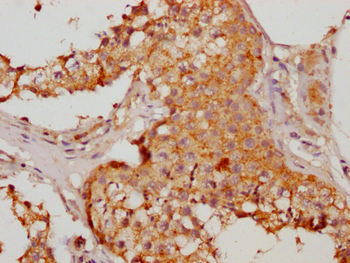HMGCL Antibody