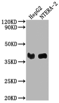 LCMT1 Antibody