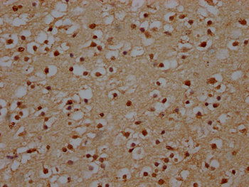 NHLRC1 Antibody