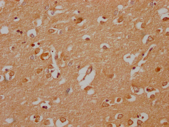 PLCB2 Antibody