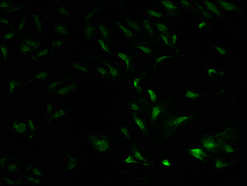 PLCB2 Antibody