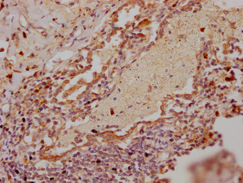 RNF122 Antibody