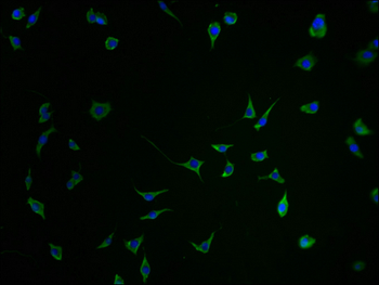SEZ6 Antibody