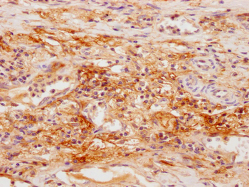 SFTPD Antibody