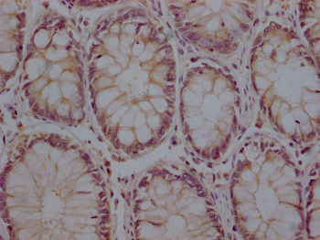 ZP2 Antibody