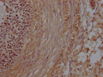 ZP2 Antibody