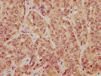HIST1H2BC Antibody
