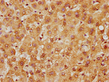 HIST1H2BC Antibody